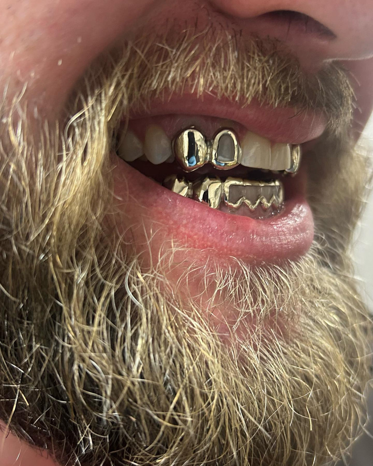 10K Two Piece Custom Gold Grillz
