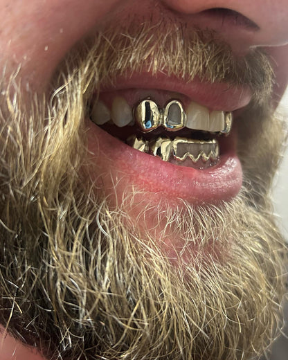 10K Two Piece Custom Gold Grillz
