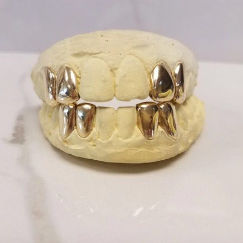 10K Two Piece Custom Gold Grillz