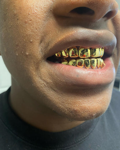 Miami Gold 8 Top 8 Bottom Custom Grillz
