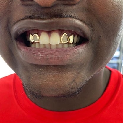 10K Two Piece Custom Gold Grillz
