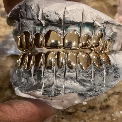 Miami Gold 10 Top 10 Bottom Custom Grillz