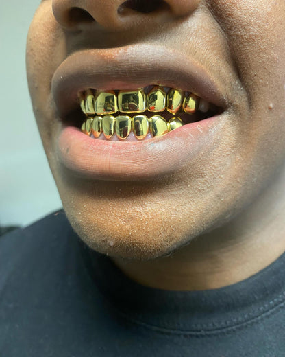 Miami Gold 8 Top 8 Bottom Custom Grillz