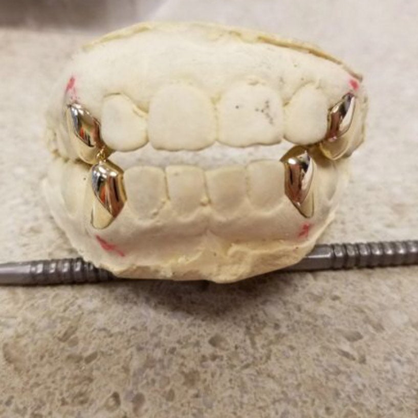 Miami Gold Two - Teeth Custom Grillz
