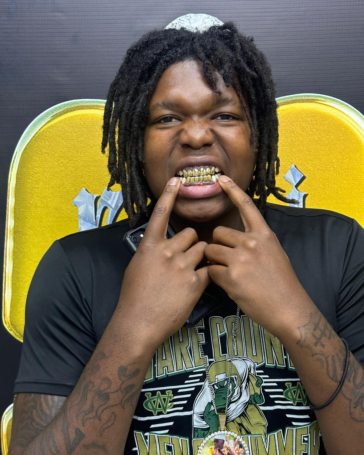 Miami Gold 6 Top 6 Bottom Custom Grillz