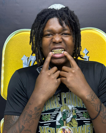 Miami Gold 6 Top 6 Bottom Custom Grillz