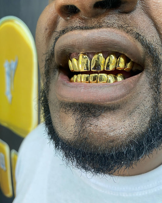 Full Set Custom Gold Grillz