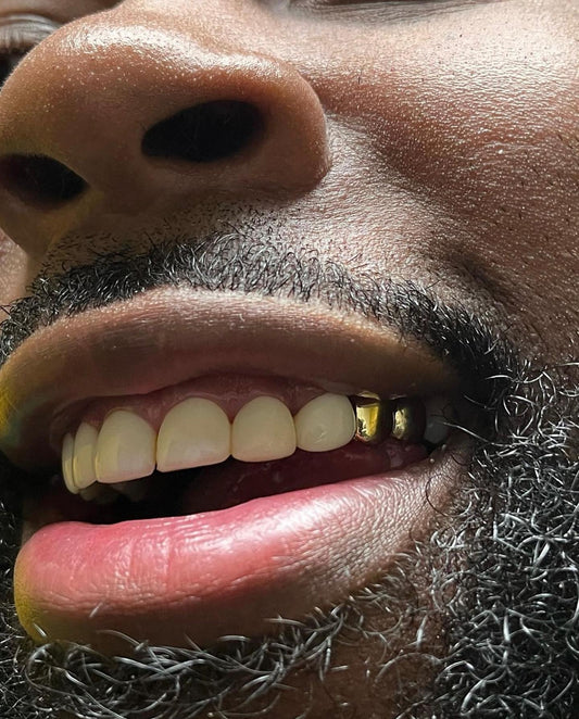 10K Two Piece Custom Gold Grillz