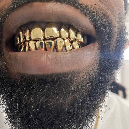 Miami Gold 10 Top 10 Bottom Custom Grillz
