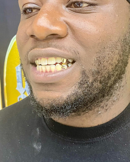 Miami Gold Two - Teeth Custom Grillz