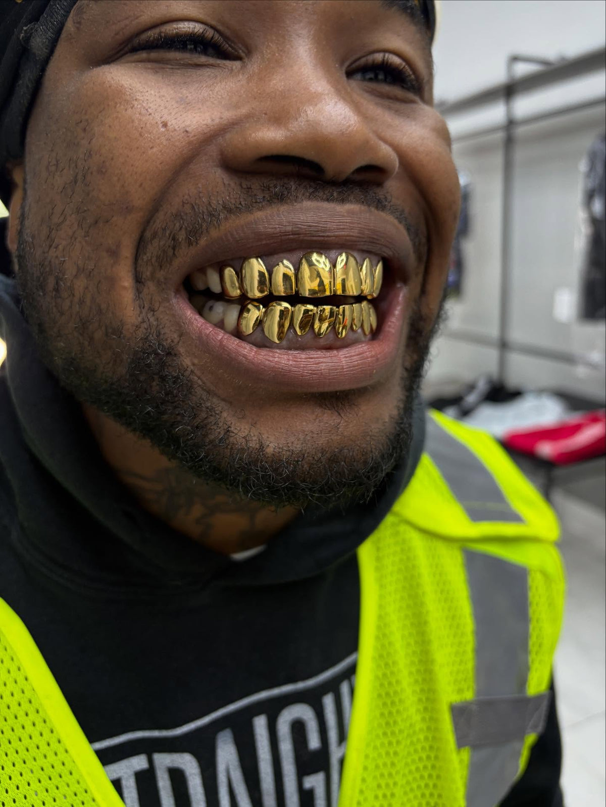 Miami Gold 8 Top 8 Bottom Custom Grillz