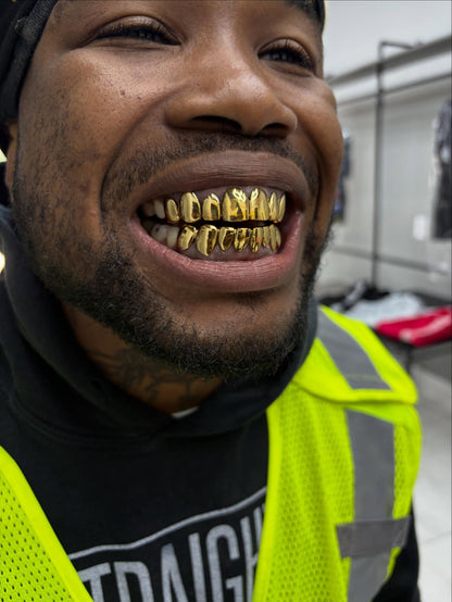 Miami Gold 8 Top 8 Bottom Custom Grillz