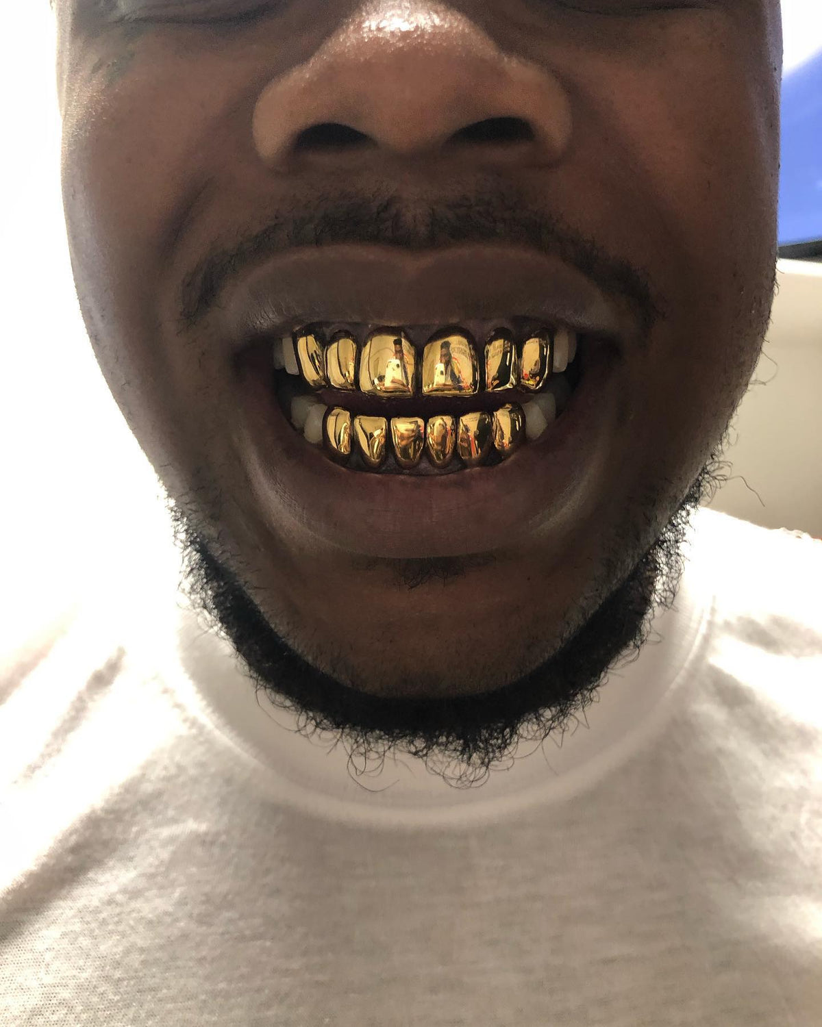 Miami Gold 6 Top 6 Bottom Custom Grillz