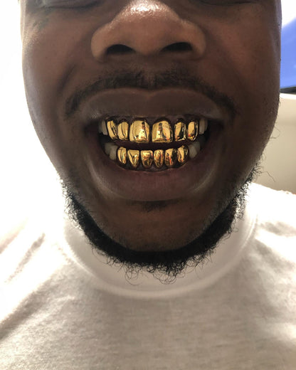 Miami Gold 6 Top 6 Bottom Custom Grillz