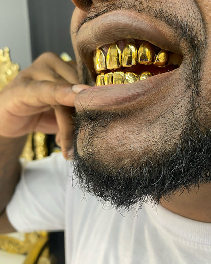Miami Gold 8 Top 8 Bottom Custom Grillz